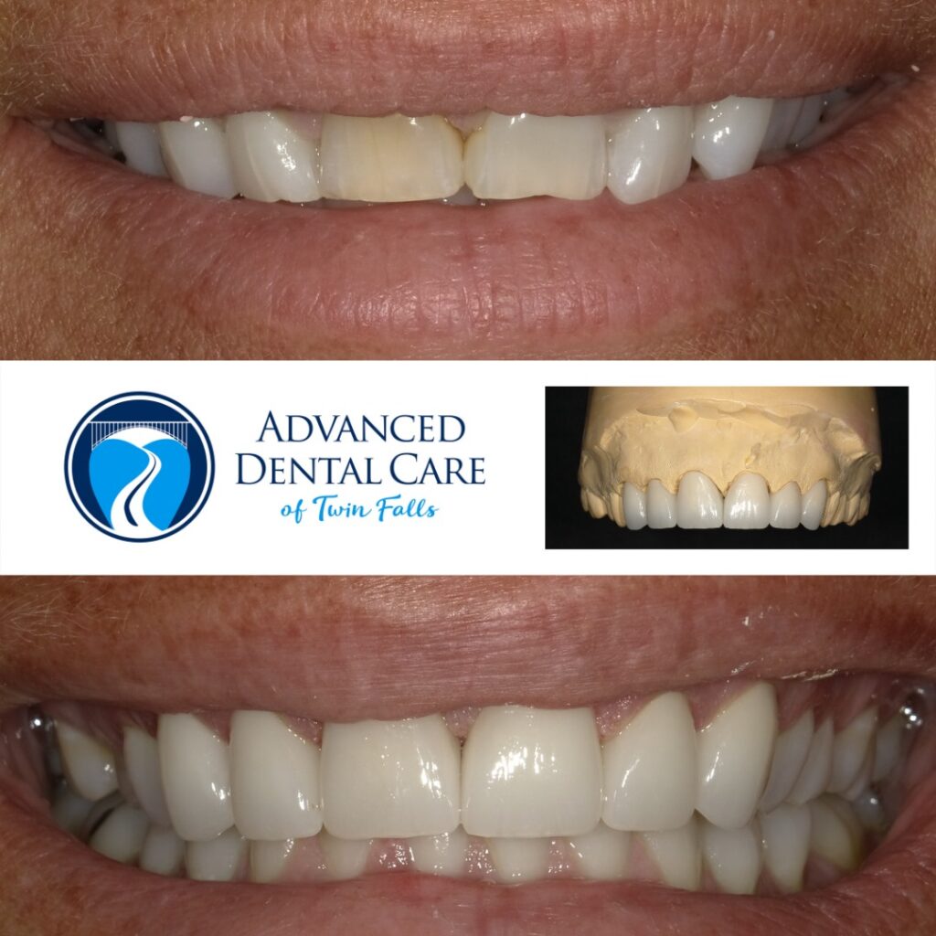 Exploring the Benefits of General Dentistry