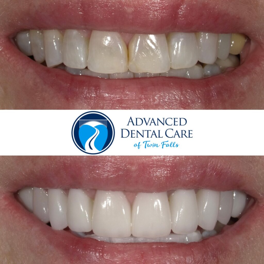 Revitalize Your Confidence